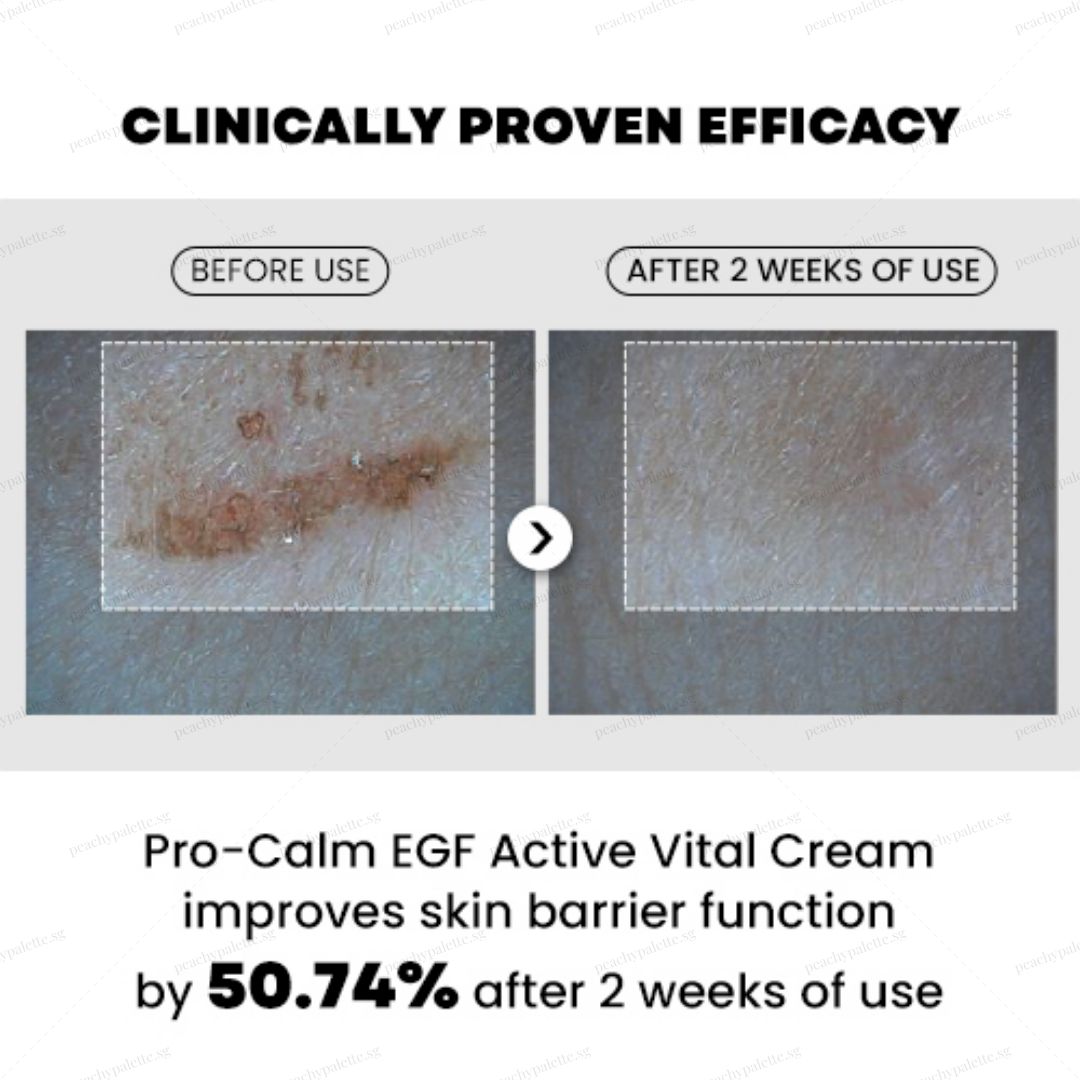 [Hanmi] Pro-Calm EGF Active Vital Repair Cream & EGF Sun Cream - Nourishing Skin Barrier